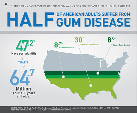 Gum Disease Treatment - Waco, TX - Laser Dentistry