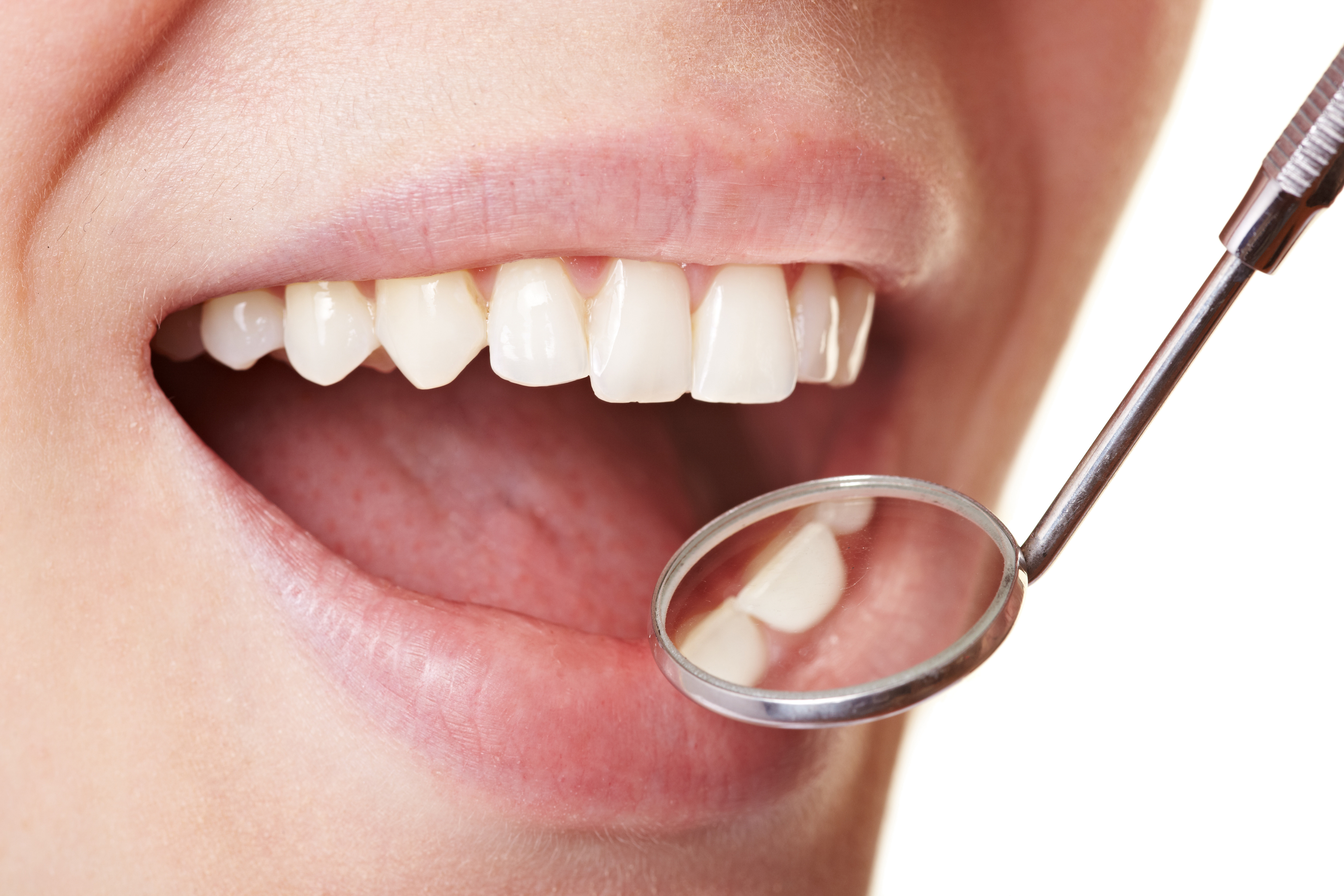 Состояние гигиены полости рта. Красивые зубы.