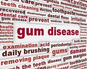 Image list of preventative care for gum disease